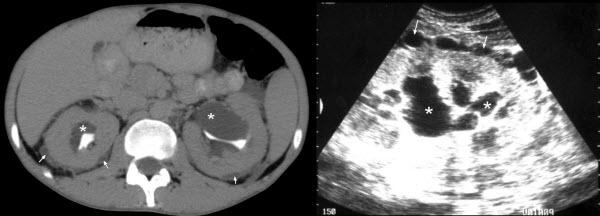 referred abdominal pain. of vague abdominal pain,
