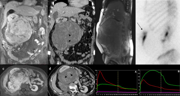 Case report journal radiology impact