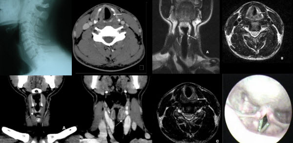 essays in radiology