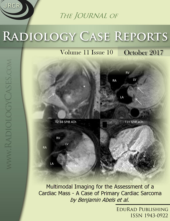 Journal of Radiology Case Reports October 2017 issue