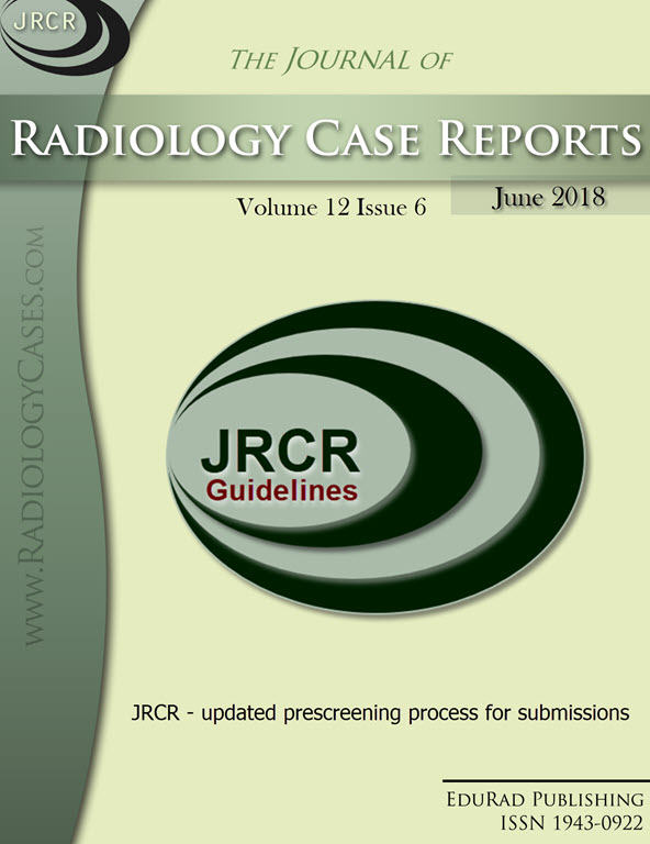 Journal of Radiology Case Reports June 2018 issue - Cover page: JRCR - updated prescreening process for submissions
