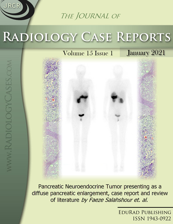 Journal of Radiology Case Reports January 2021 issue - Cover page: Pancreatic Neuroendocrine Tumor presenting as a diffuse pancreatic enlargement, case report and review of literature by Faeze Salahshour et. al.