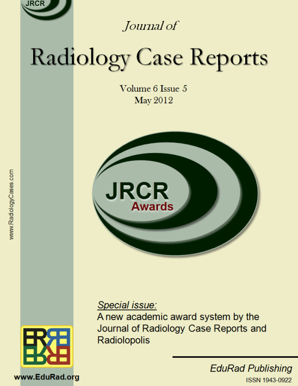 Journal of Radiology Case Reports May 2012 special issue - A new academic award system by the Journal of Radiology Case Reports and Radiolopolis