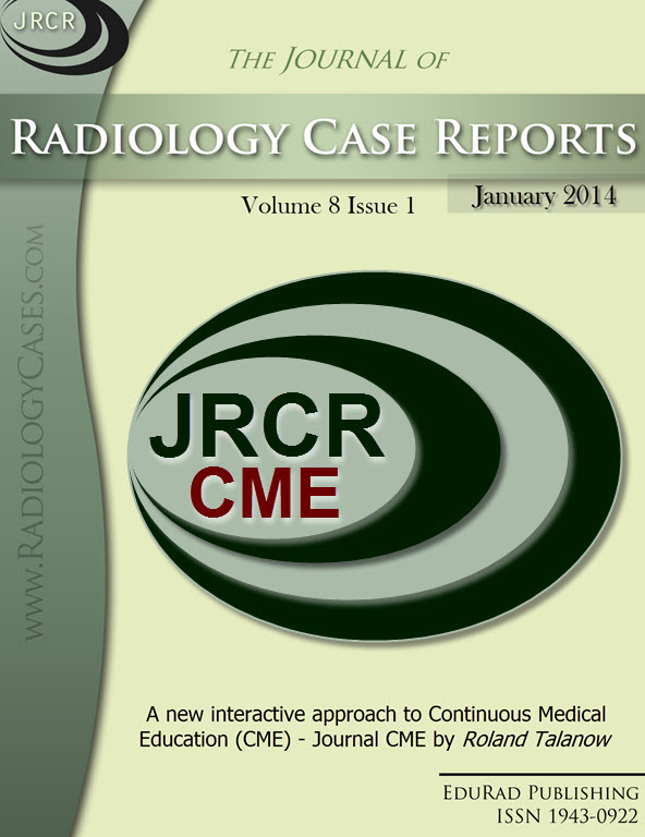 Journal of Radiology Case Reports January 2014 issue - Cover page: A new interactive approach to Continuous Medical Education (CME) - Journal CME by Roland Talanow